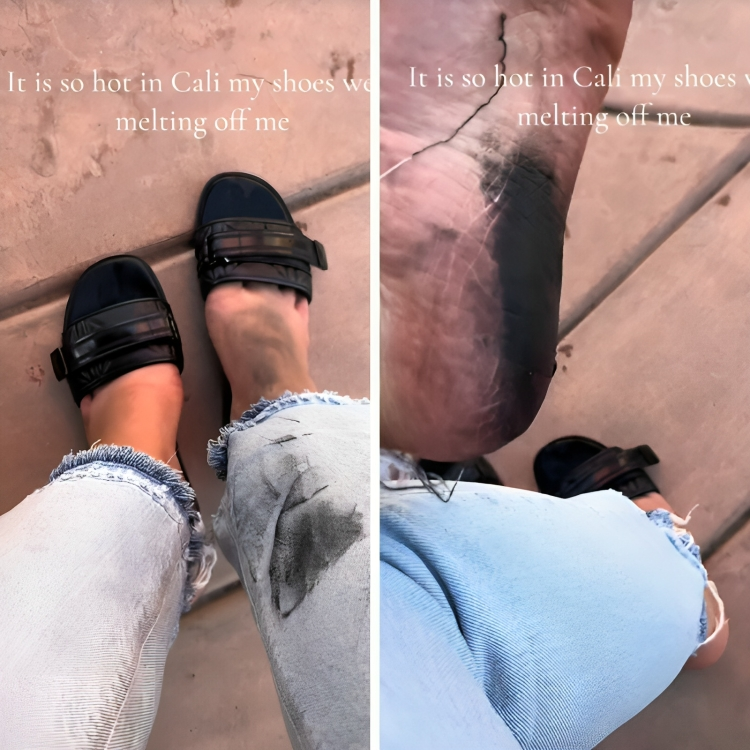 Kupila natikače u Aldu, kaže da su se otopile od vrućine: "Birkenstock ne bi nikada"