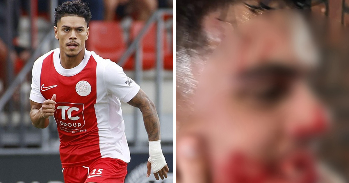 UZNEMIRUJUĆA FOTOGRAFIJA Trener u Nizozemskoj nokautirao igrača, izbio mu sedam zuba