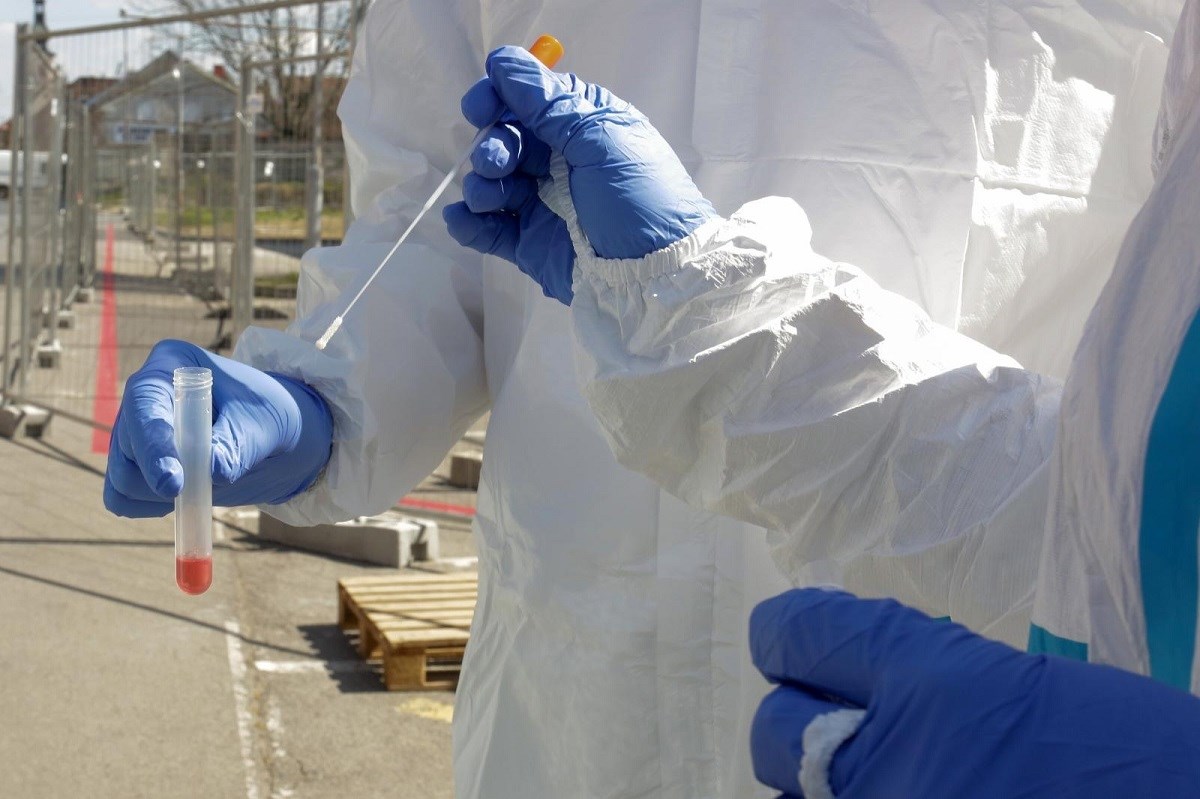 U Osječko-baranjskoj županiji 35 novozaraženih