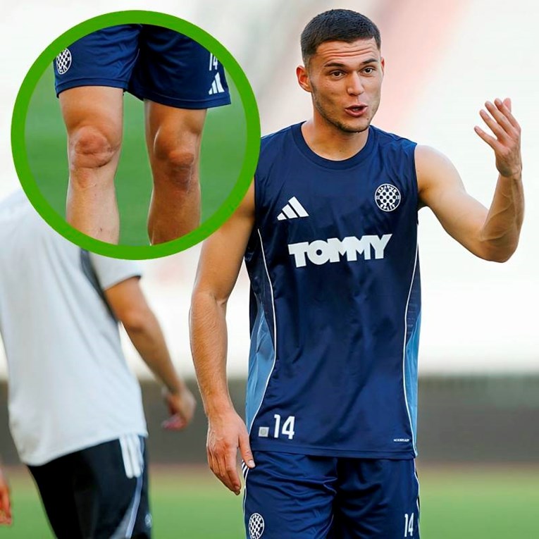 Navijači Hajduka zabrinuti zbog novog igrača. Riječ je o operaciji koju je davno imao