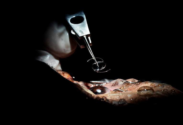 Liječnici u Londonu revolucionarnom injekcijom gela vraćaju vid