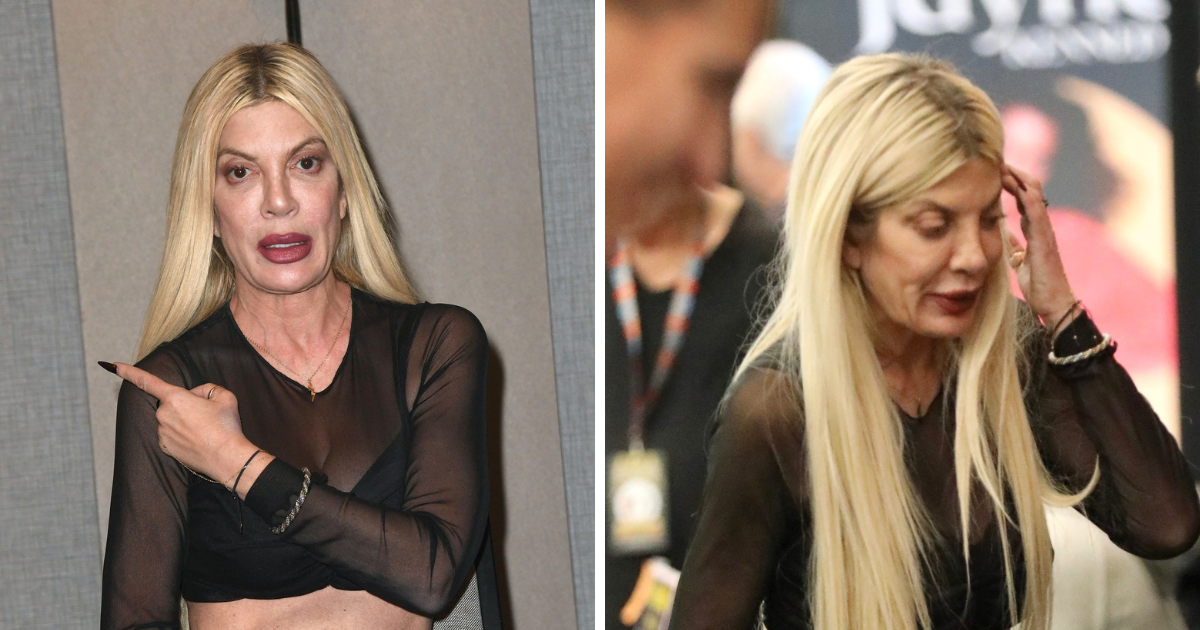 Ljudi šokirani izgledom Tori Spelling: "Previše operacija"