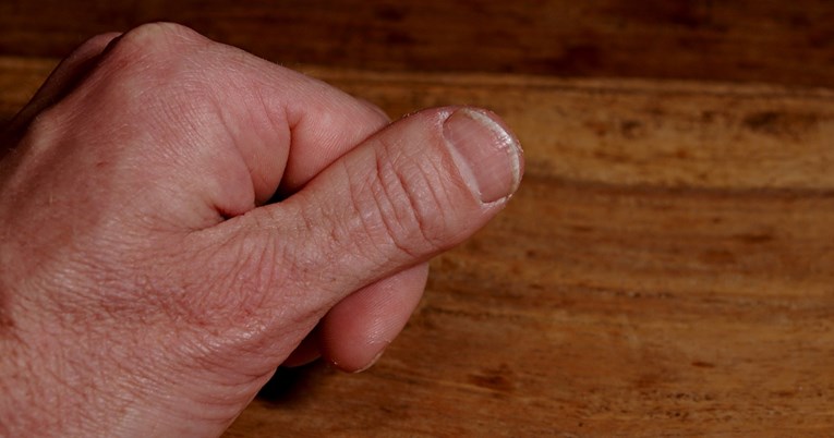 Neobična promjena na prstima mogla bi biti znak raka pluća, nemojte je ignorirati