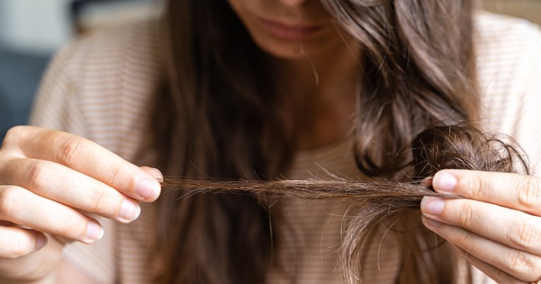 Četiri najčešće greške u njezi kose zbog koje ona postaje tanka, kažu dermatolozi