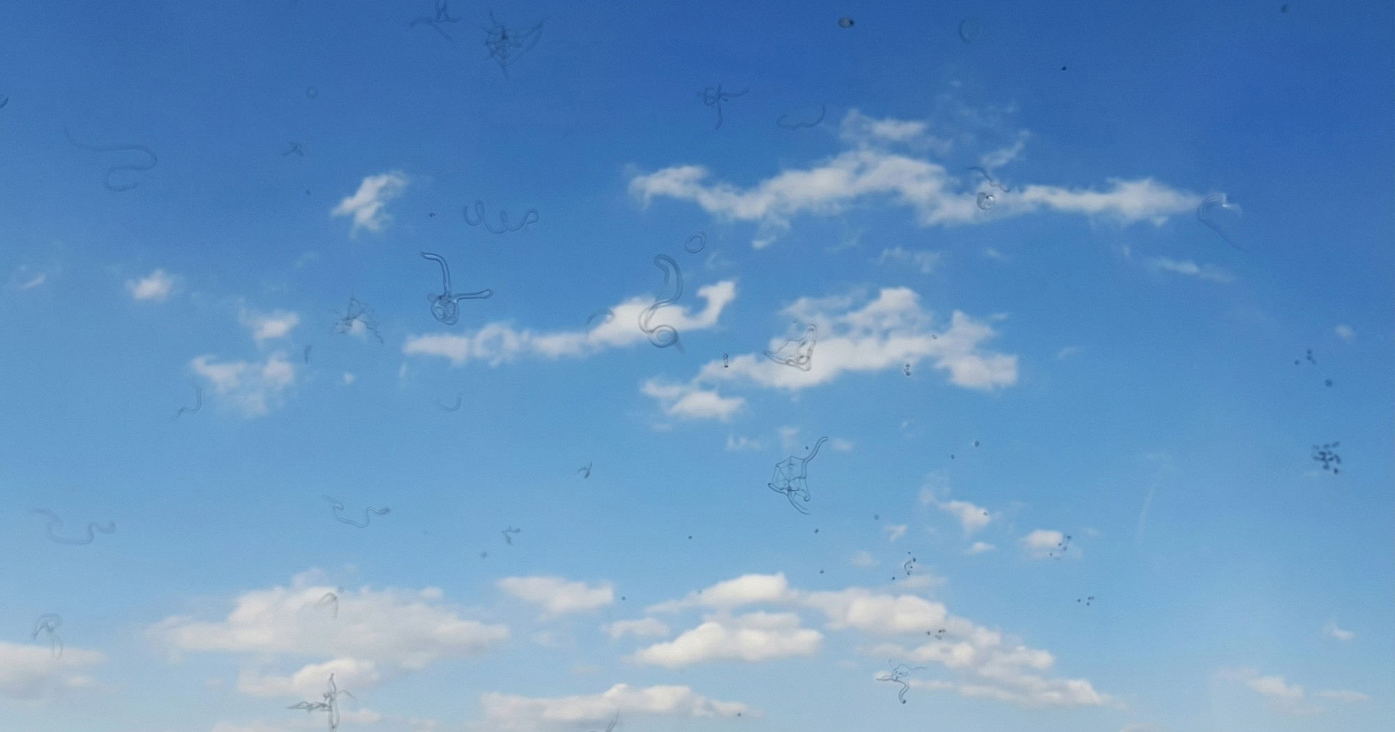 Pojava "mušica" u oku može biti znak ozbiljnog zdravstvenog problema