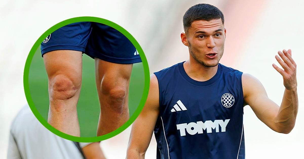 Navijači Hajduka zabrinuti zbog novog igrača. Riječ je o operaciji koju je davno imao