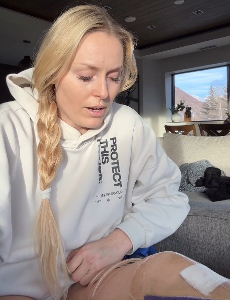 VIDEO Vonn otkrila da je zamalo ostala bez noge. "Doktor ju je razrezao i spasio me"