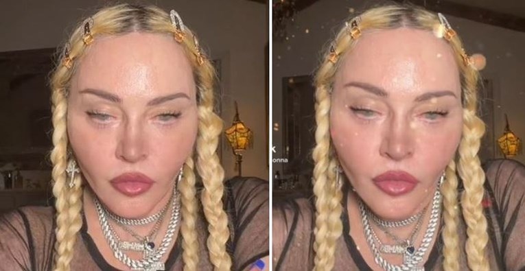 Madonnin novi video zabrinuo fanove: "Što je to učinila od sebe?"
