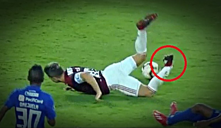VIDEO Brazilac Diego doživio težak lom noge. Javio mu se i Klasnić