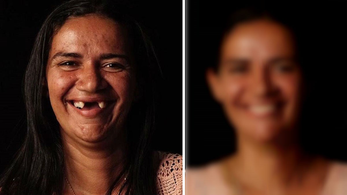 Zubar besplatno popravlja zube siromašnima, njihove transformacije su čudesne