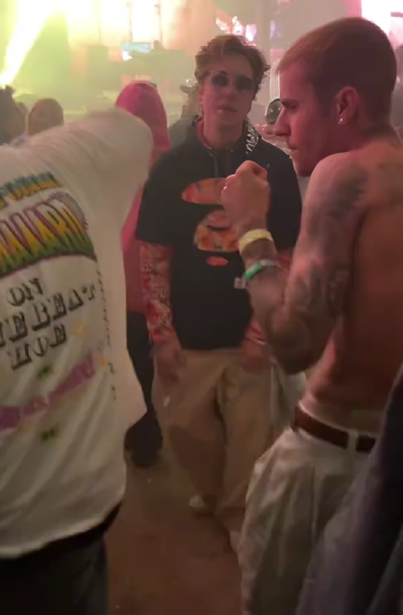 Uznemirujuća snimka Justina Biebera na Coachelli: "On je potpuno slomljen"