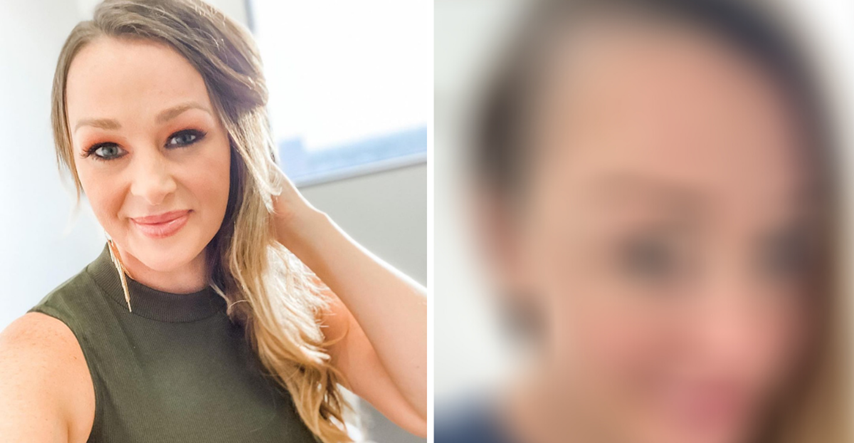 Reality zvijezda se požalila na gubitak kose nakon porođaja