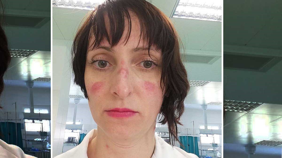 Ovo je slika doktorice iz Čakovca nakon što je spasila korona-sumnjivog pacijenta