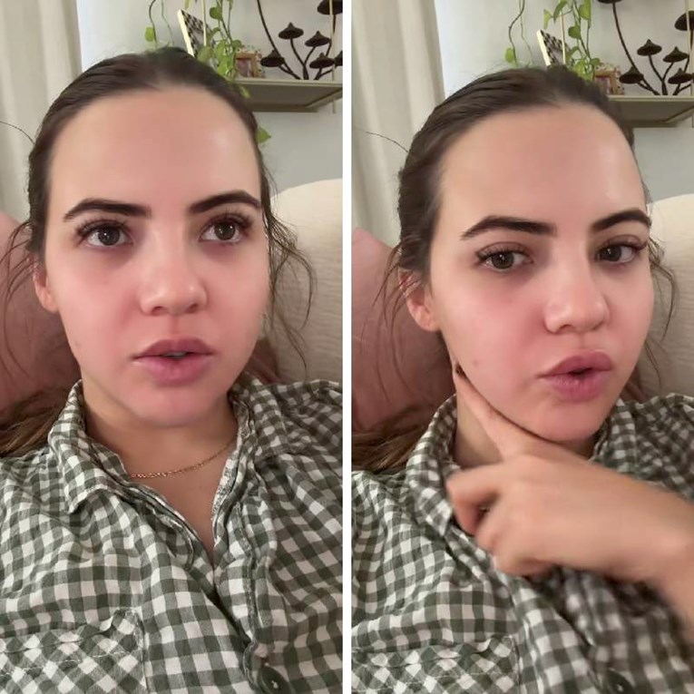 Influencerica pokazala posljedice koje ima od botoksa
