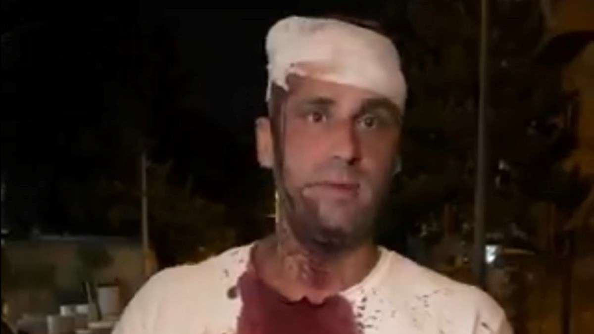 VIDEO U Beogradu pretučen zastupnik: "Šipkama su me udarali po glavi"