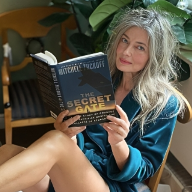 Bivši supermodel operirao kuk i pokazao ožiljke: "Oni su dio mene, prihvaćam ih"