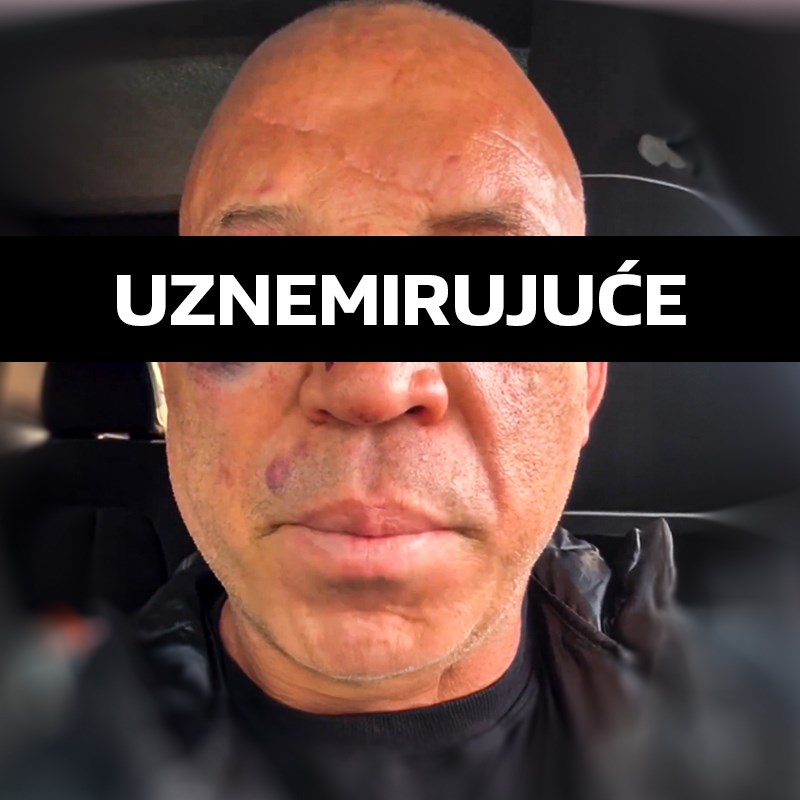 Silva se oglasio nakon što je brutalno nokautiran u makljaži: Jako mi je loše