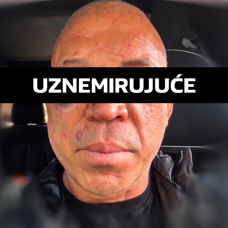Wanderlei Silva nakon makljaže: Ne mogu obaviti poslove zbog lica. Idem na sud