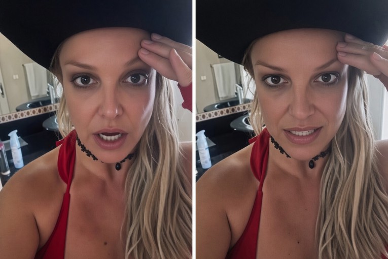 Britney Spears o neuspjelom botoksu: "Ne možete nikome vjerovati"