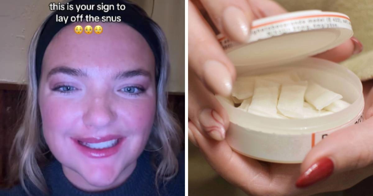 Pokazala je posljedice uzimanja snusa. Taj nikotinski proizvod mladi sve više koriste