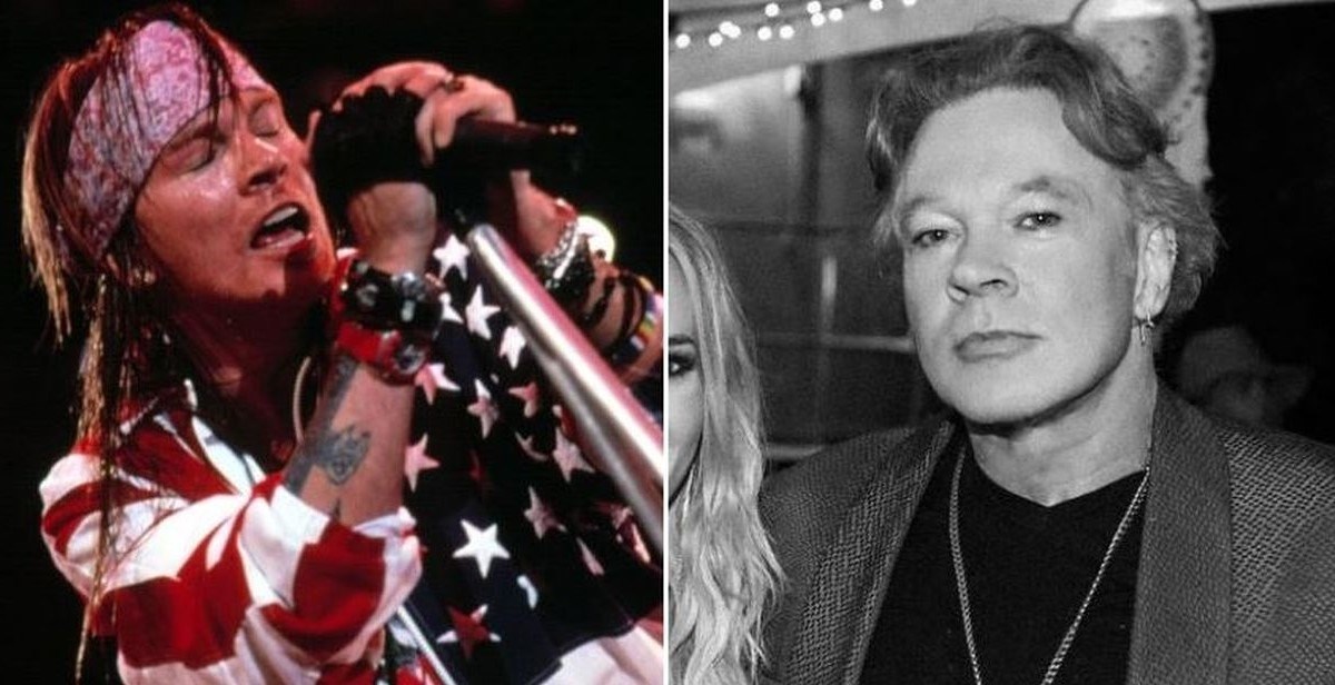 Axl Rose šokirao izgledom na koncertu, ljudi pišu: Trebao je pustiti lice na miru