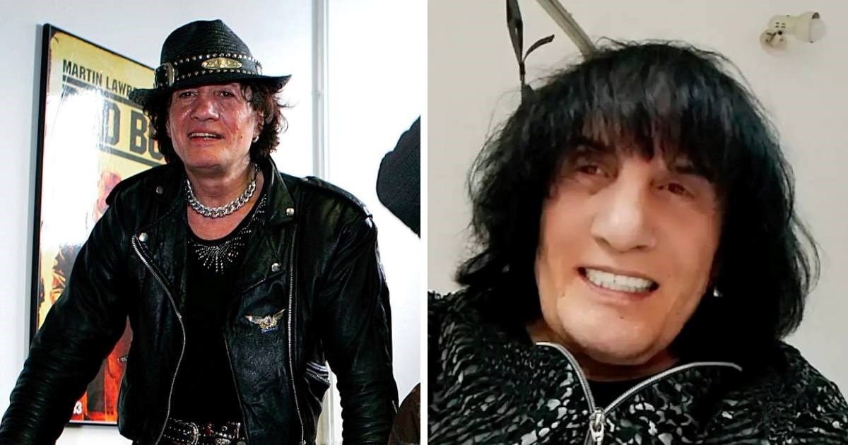 Vukašinović se javio iz bolnice: Kad mi bude noga gotova, nećete znati koja je koja