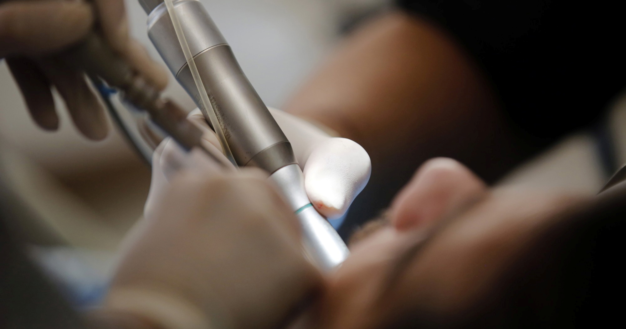 U Britaniji si oduzeo život nakon što je zbog zahvata u Turskoj ostao bez zuba