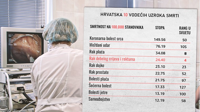 Hrvatska je u svjetskom vrhu po raku debelog crijeva. Ovo su glavni razlozi za to