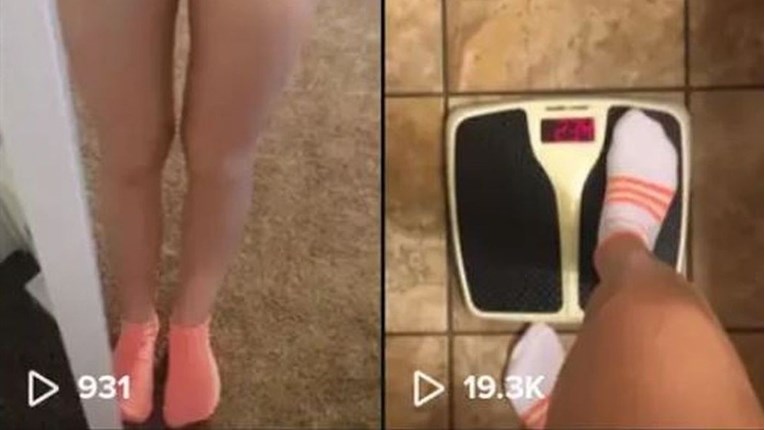 "Potiču anoreksiju": Omiljena aplikacija tinejdžera puna zabrinjavajućih snimki