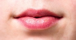 Što više mažete usne balzamom, one su suše? Dermatolog objasnio zašto