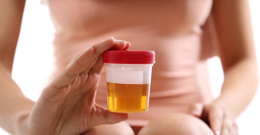 Boja urina može puno toga reći o vašem zdravlju, evo na što pripaziti