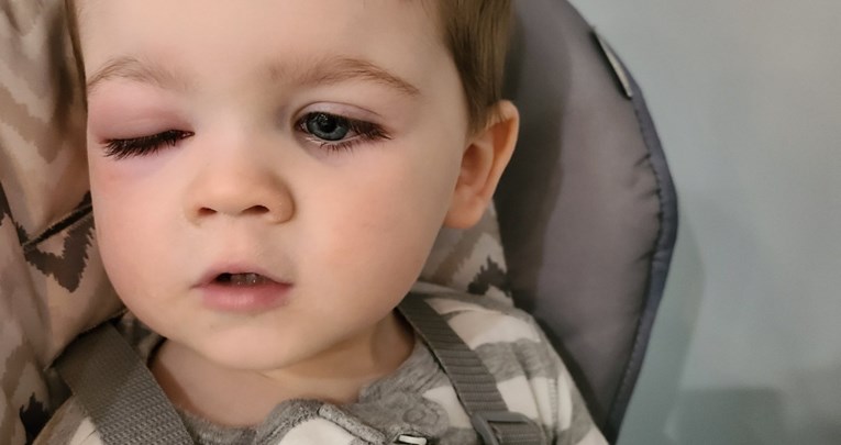 Mama upozorava: Moj sin je skoro ostao bez vida zbog igračke koju sva djeca koriste