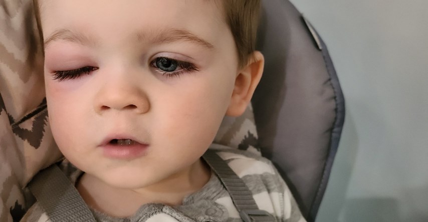 Mama upozorava: Moj sin je skoro ostao bez vida zbog igračke koju sva djeca koriste