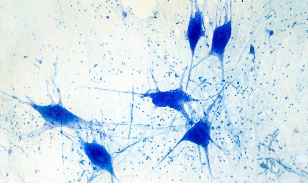 VIDEO Nakupina moždanih stanica naučila igrati igricu u 5 minuta