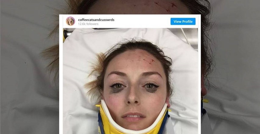 Objavila fotku iz bolničkog kreveta nakon teške nesreće, ljudi uočili jedan detalj
