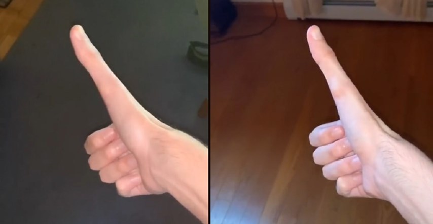Pomalo uznemirujuće snimke: Hit je na TikToku zbog nenormalno dugog palca