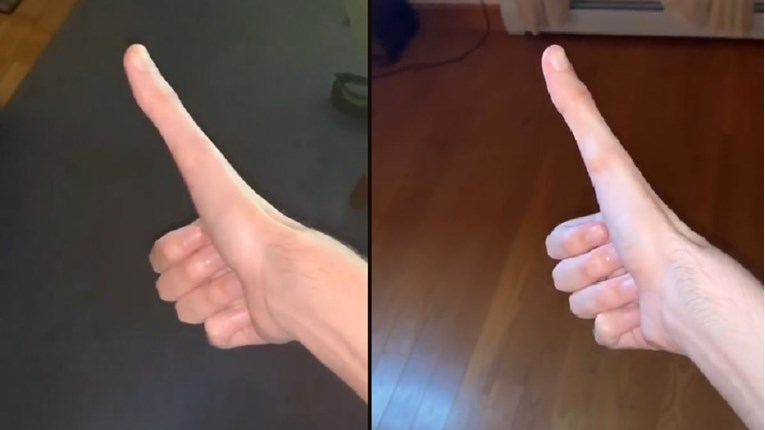 Pomalo uznemirujuće snimke: Postao je hit na TikToku zbog nenormalno dugog palca