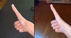 Pomalo uznemirujuće snimke: Hit je na TikToku zbog nenormalno dugog palca