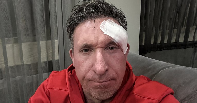 Legenda Liverpoola operirala rak. "Provjerite madeže"