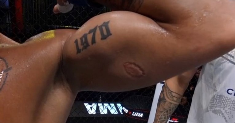 VIDEO Brazilac ugrizao protivnika i dobio ekspresni otkaz iz UFC-a