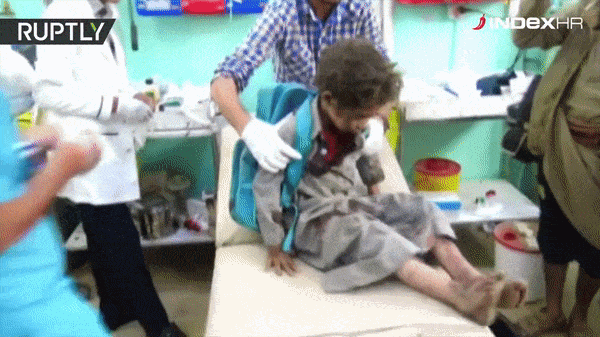 Uznemirujuće snimke: U napadu u Jemenu ubijeno najmanje 29-ero djece