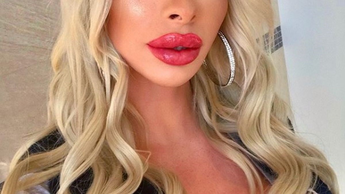 Potrošila je 130.000 kuna na operacije, tvrdi da su muškarci sad ludi za njom