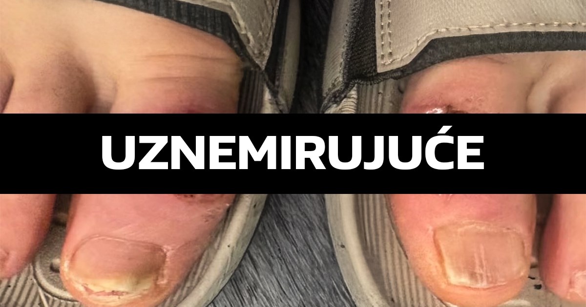 UZNEMIRUJUĆE Gaethje objavio fotografiju stopala nakon borbe: Ne želite biti borac