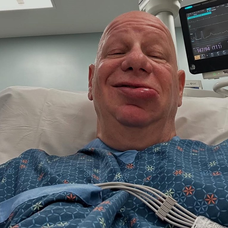 Komičar (59) završio na Hitnoj zbog alergije na sladoled, objavio fotke iz bolnice