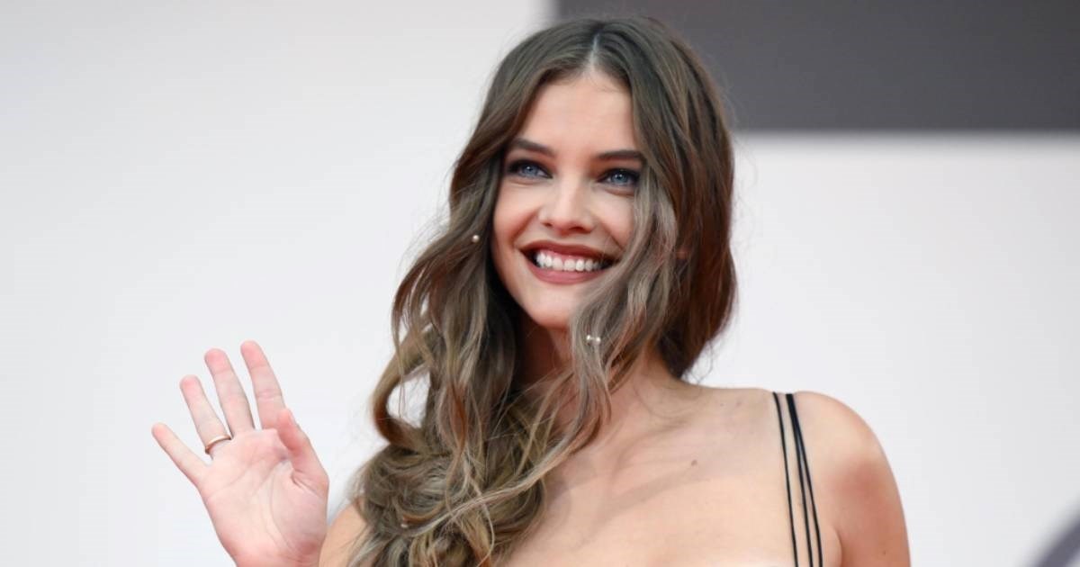 Slavna mađarska manekenka nakon operacije plijenila pažnju u Veneciji