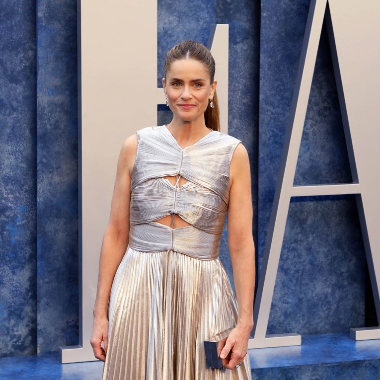 Amanda Peet: Dok su mi oba roditelja bila na samrti, saznala sam da imam rak