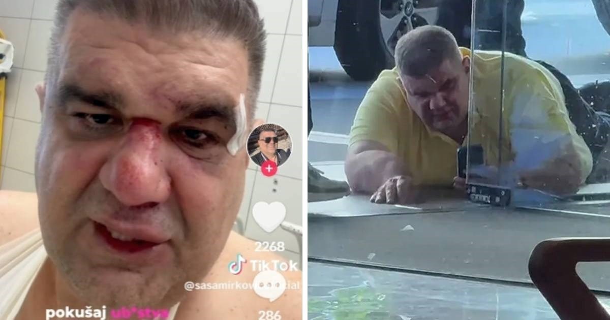 Srpski poduzetnik koji je brutalno prebijen u Zagrebu: Nitko iz hotela nije izašao