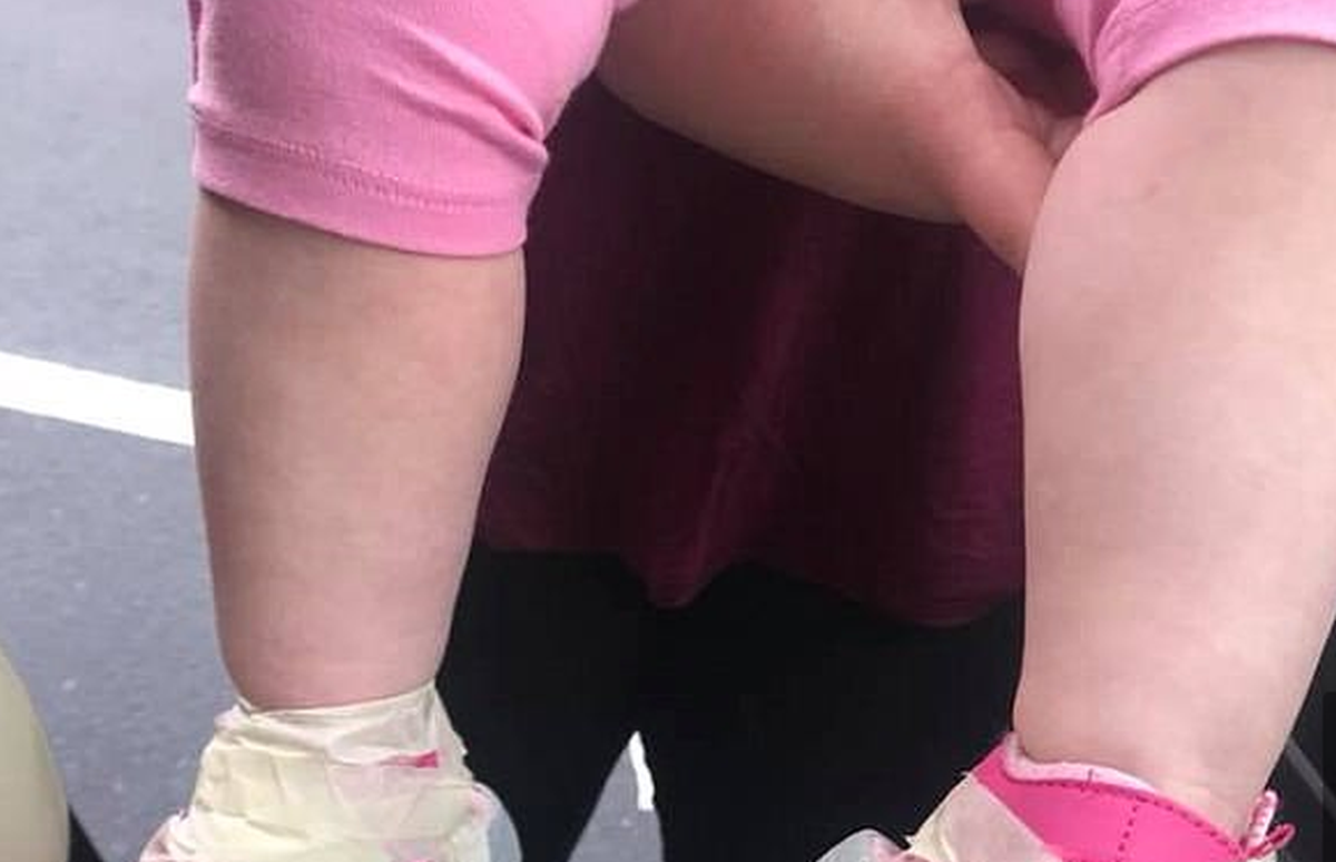 Mama pobjesnila kad je vidjela što su tete u vrtiću učinile njenoj 17-mjesečnoj kćerkici