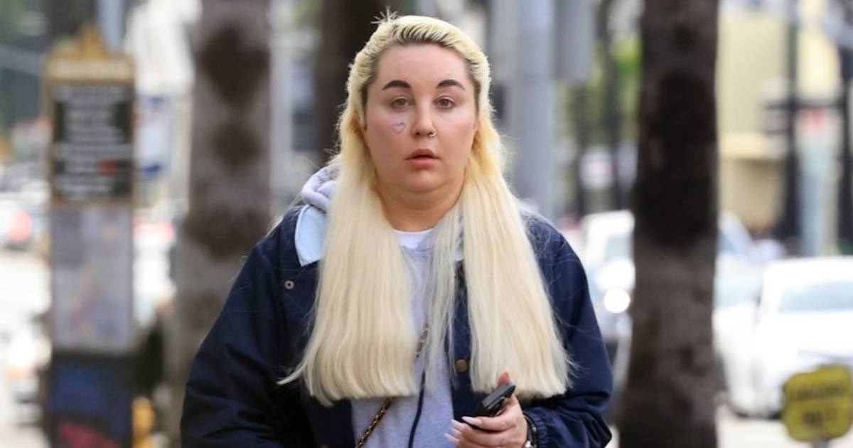 Amanda Bynes priznala da koristi Ozempic: Želim bolje izgledati na paparazzi fotkama