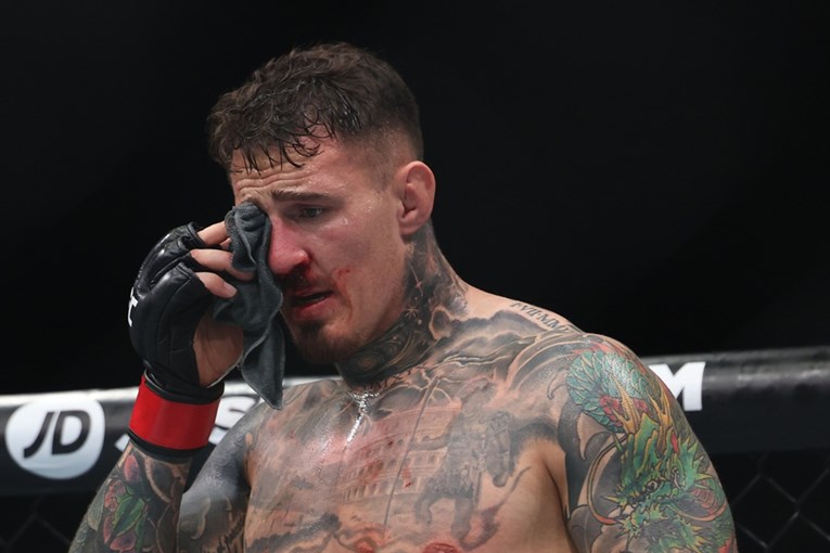 Tom Aspinall potvrdio da mora na operaciju oka: Noćna mora